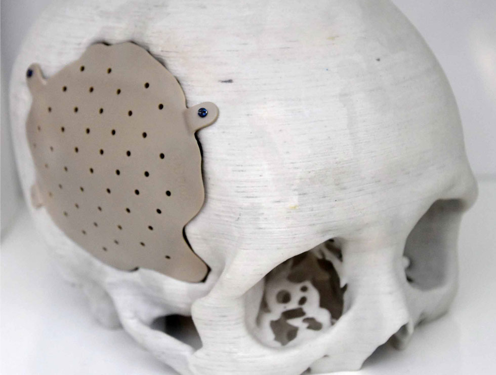 �@������ɫ�ĸ�ˎ��������Ŀ��������3D��ӡ���XĤ��